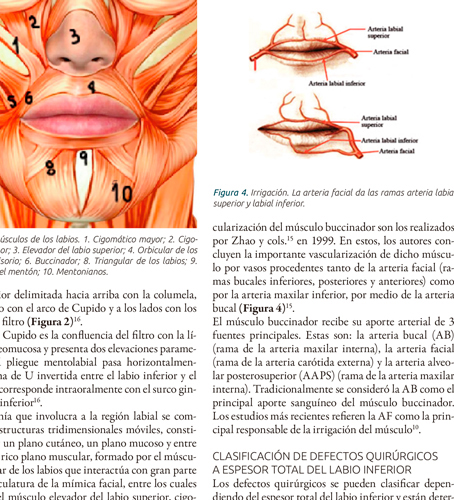 Reconstrucción del labio inferior con colgajo miomucoso del buccinador por hemangioma congénito: a propósito de un caso