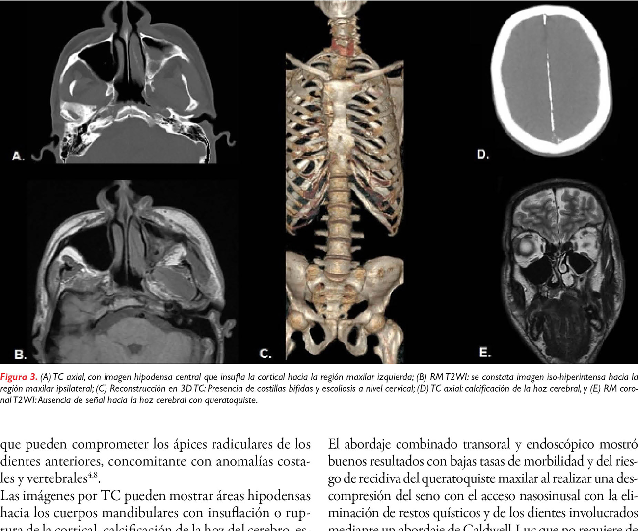 Aspectos claves por clínica e imagen seccional en síndrome de Gorlin-Goltz: caso clínico